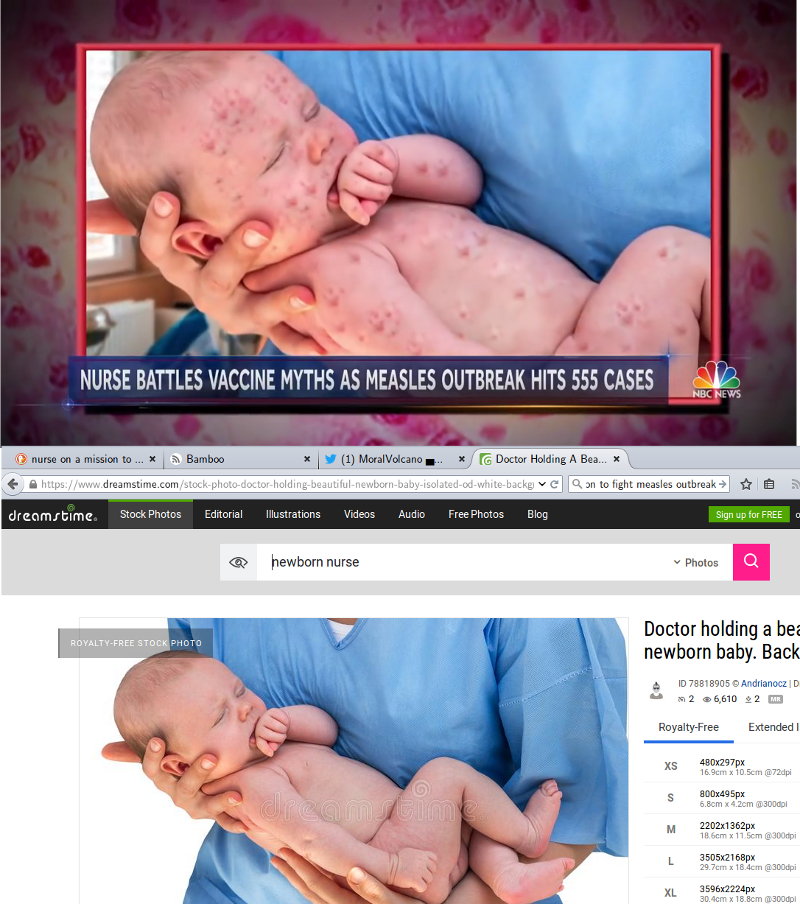 NBC News uses doctored stock photo of healthy baby to create false propaganda against vaccine opponents